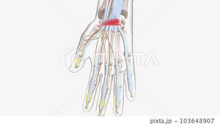 Carpal Tunnel Syndrome - Wrist Pain isolated on white (transparent bones) 103648907