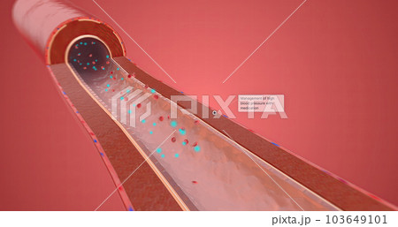 Management of high blood pressure with medication 103649101