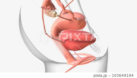 Gonorrhea is a sexually transmitted infection caused by the bacterium Neisseria gonorrhoeae Gonorrhea is a sexually transmitted infection caused by the bacterium Neisseria gonorrhoeae 103649194