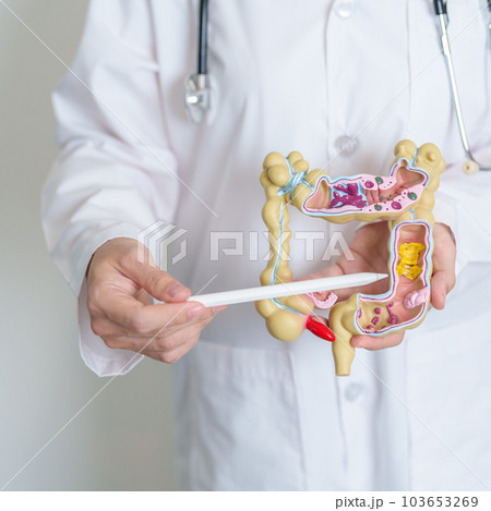 Doctor holding human Colon anatomy model. Colonic disease, Large Intestine, Colorectal cancer, Ulcerative colitis, Diverticulitis, Irritable bowel syndrome, Digestive system and Health concept Doctor holding human Colon anatomy model. Colonic disease, Large Intestine, Colorectal cancer, Ulcerative colitis, Diverticulitis, Irritable bowel syndrome, Digestive system and Health concept 103653269