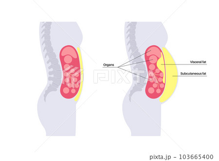 Visceral fat diagram 103665400