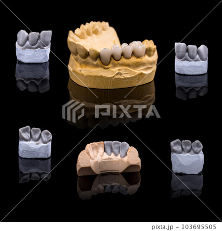 Artificial tooth 103695505