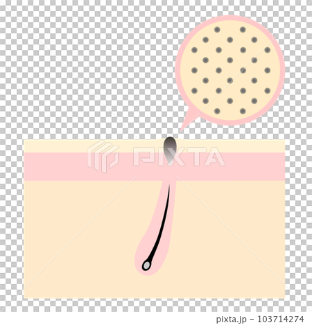 Skin with dark spots. Image of skin trouble. 103714274