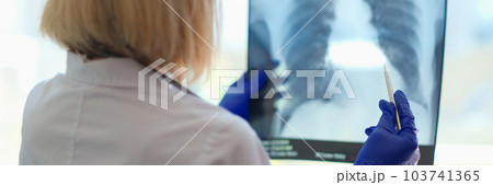 Doctor pulmonologist examining x-ray photograph of lungs Doctor pulmonologist examining x-ray photograph of lungs 103741365