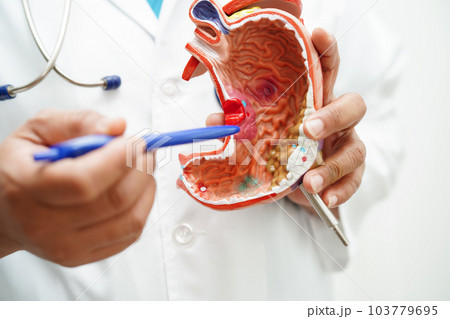 Stomach disease, doctor holding anatomy model for study diagnosis and treatment in hospital. 103779695