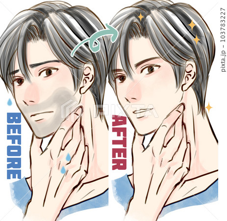 ひげ脱毛した男性のビフォーアフター ひげ脱毛した男性のビフォーアフター 103783227