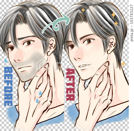 ひげ脱毛した男性のビフォーアフター ひげ脱毛した男性のビフォーアフター 103783227