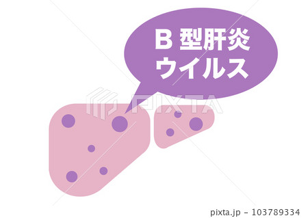 B型肝炎ウイルスに感染した肝臓のイラスト 103789334