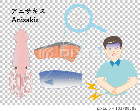 異尖線蟲(寄生蟲)引起的食物中毒插圖集 異尖線蟲(寄生蟲)引起的食物中毒插圖集 103789388