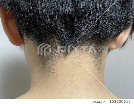 ショートカットの襟足（うなじ） 103800612