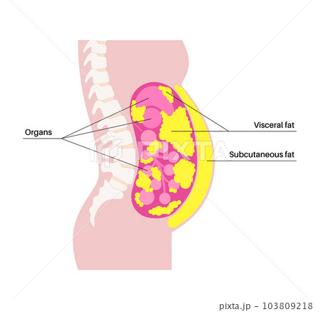 Visceral fat diagram 103809218