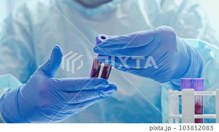 Blood diagnostics. Laboratory analysis. Microbiology test. Medical worker with hands in protective rubber gloves studying examining samples tubes. Blood diagnostics. Laboratory analysis. Microbiology test. Medical worker with hands in protective rubber gloves studying examining samples tubes. 103852083