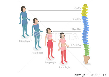 3D Isometric Flat Vector Conceptual Illustration of Tetraplegia And Paraplegia 103856213