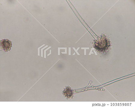 肺などに入ると危ないアスペルギルス 肺などに入ると危ないアスペルギルス 103859807