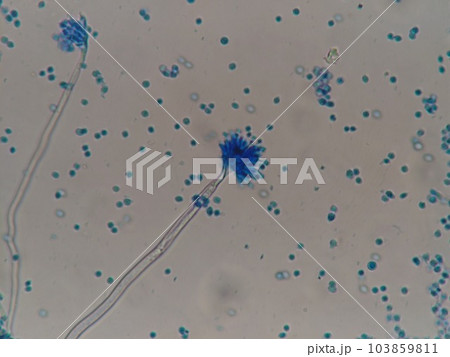 染色したカビの顕微鏡写真 103859811