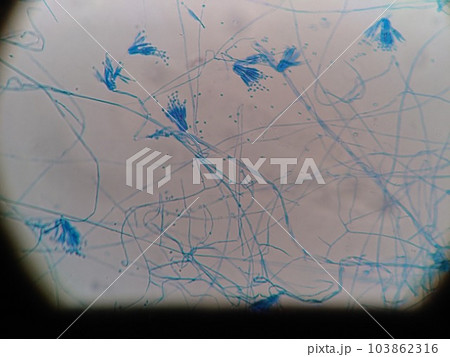 冷蔵庫から見つかったカビの胞子 冷蔵庫から見つかったカビの胞子 103862316