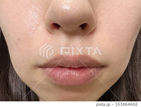 口周り 毛穴イメージ 口周り 毛穴イメージ 103864608