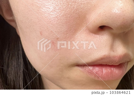 口周り　毛穴　イメージ 103864621