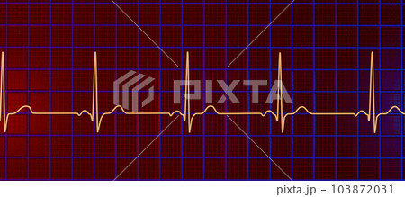 A normal electrocardiogram, 3D illustration displaying the electrical activity of the heart in a healthy individual, 103872031