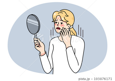 Unhappy woman look in mirror worrying about acne 103876171