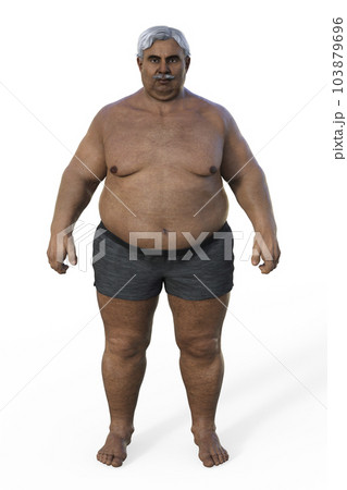 A whole-body representation of a senior Indian man with overweight body composition, highlighting the physiological implications of excess weight, 3D illustration A whole-body representation of a senior Indian man with overweight body composition, highlighting the physiological implications of excess weight, 3D illustration 103879696