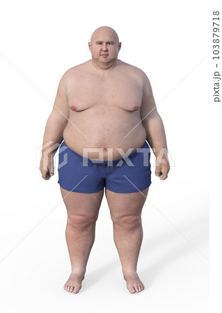 A whole-body representation of a man with overweight body composition, highlighting the physiological implications of excess weight, 3D illustration A whole-body representation of a man with overweight body composition, highlighting the physiological implications of excess weight, 3D illustration 103879718