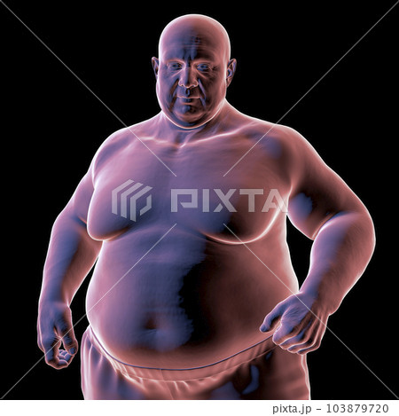 A man with overweight body composition, 3D illustration highlighting the physiological implications of excess weight 103879720