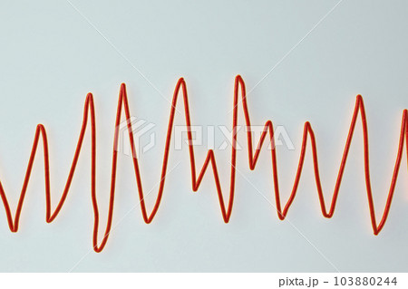 Electrocardiogram ECG displaying Torsades de...のイラスト素材 [103880244] - PIXTA