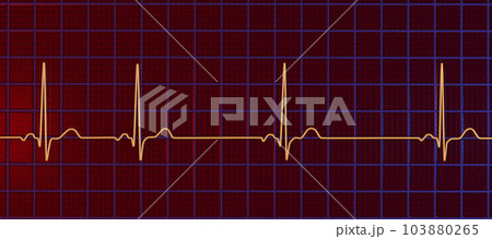 Electrocardiogram ECG displaying sinus arrhythmia, 3D illustration 103880265