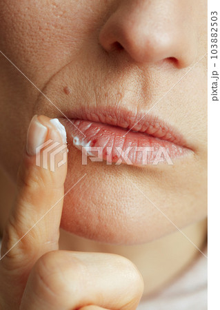 40 years old woman applying ointment using finger on beige 103882503