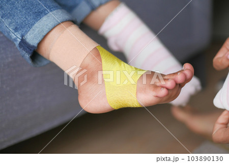 little child with plaster bandage on leg. 103890130