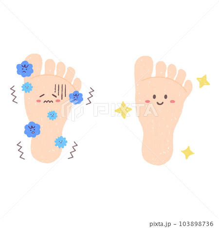 きれいな足の裏と菌が繁殖する足の裏 キャラクター きれいな足の裏と菌が繁殖する足の裏 キャラクター 103898736