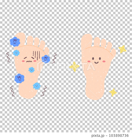 きれいな足の裏と菌が繁殖する足の裏 キャラクター きれいな足の裏と菌が繁殖する足の裏 キャラクター 103898736