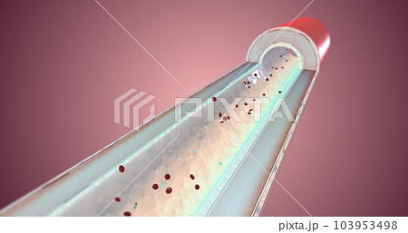 A healthy artery has supple and muscular walls that help blood flow. A healthy artery has supple and muscular walls that help blood flow. 103953498