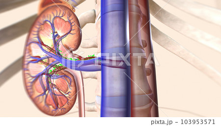 The kidneys help your body by excreting excess sodium into the ureter, where it is flushed away with the urine. 103953571