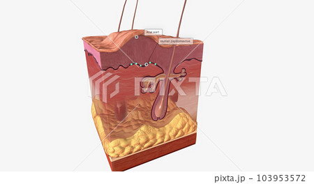 Most anal warts are caused by human papillomavirus (HPV) Most anal warts are caused by human papillomavirus (HPV) 103953572