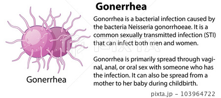 Gonorrhea virus with explanation 103964722