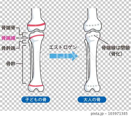 骨端線 子どもの骨と、大人の骨のイラスト素材 [103971385] - PIXTA