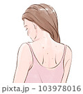 女性の背中の肌荒れ 103978016