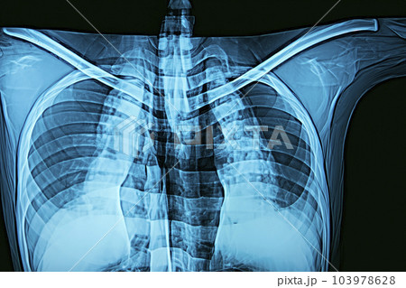X-ray. X-ray of head, foot, head, mouth, ribs and hands. Bone scan. Body injury. X-ray analysis of human teeth. Xray of a human thorax isolated X-ray. X-ray of head, foot, head, mouth, ribs and hands. Bone scan. Body injury. X-ray analysis of human teeth. Xray of a human thorax isolated 103978628