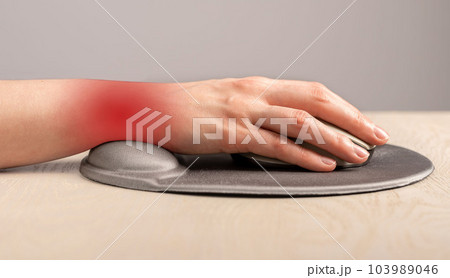 Wrist pain, ache concept. Hand lying on computer mouse with supporting gel pad Wrist pain, ache concept. Hand lying on computer mouse with supporting gel pad 103989046