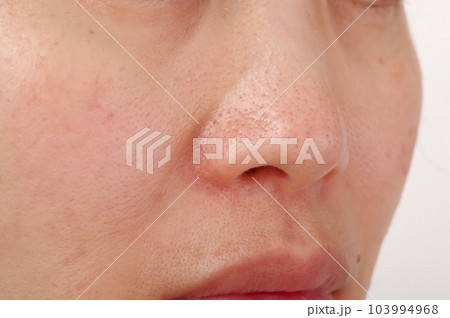 40代女性の顔の鼻まわり 103994968