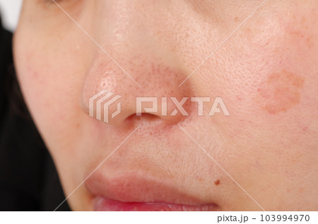 40代女性の顔の鼻まわり 103994970