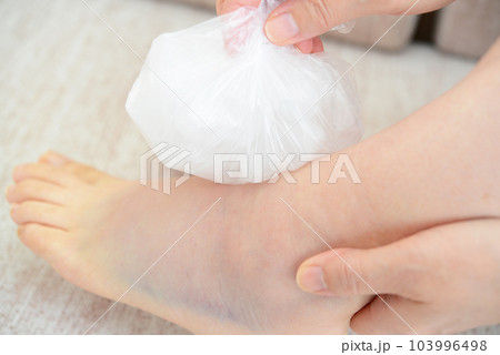 捻挫した女性の足 103996498