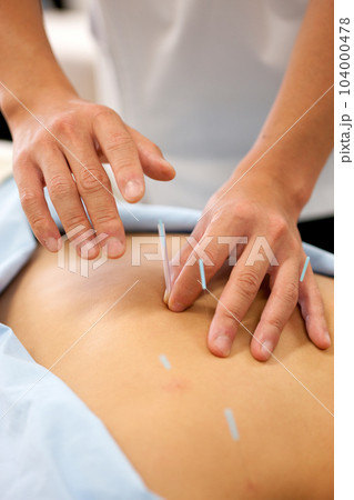 鍼灸・鍼治療 104000478