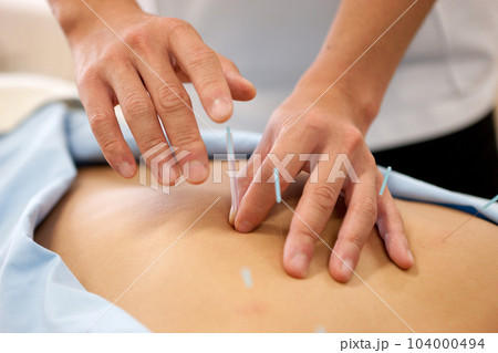 鍼灸・鍼治療 104000494