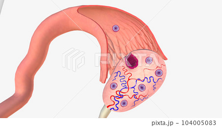 Ovulation is the process of releasing a mature egg from the ovary into the fallopian tube of the uterus. 104005083