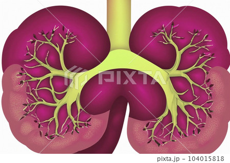 Kidney. Human kidney cross section. Menschliche Nieren. Human kidney Stones Medical Concept. Beautiful abstract kidneys with nebula dust concept, contemporary colors and mood social background. 104015818