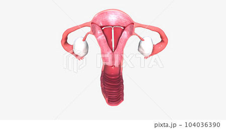intra uterine device inside fantom uterus intra uterine device inside fantom uterus 104036390