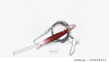 The inferior oblique is an extraocular muscle that arises in the front of the orbit near the nose. 104036452